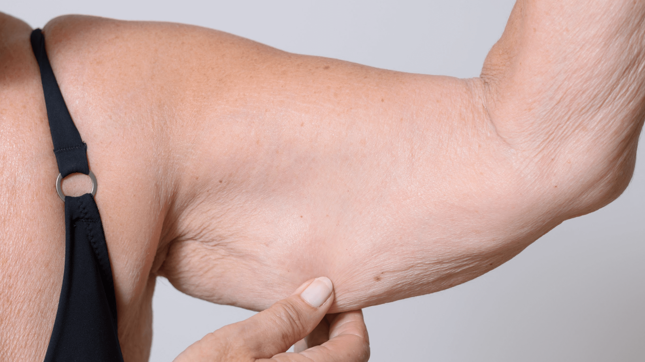 woman holding loose arm skin
